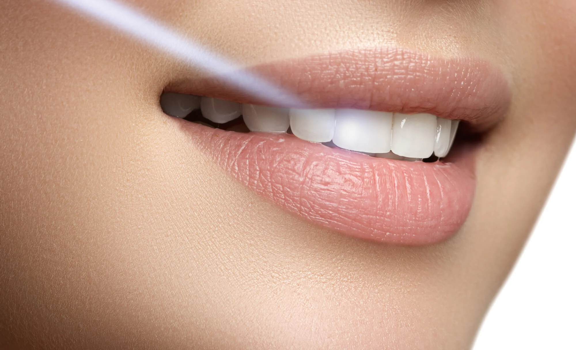 Most Asked Questions About Laser Dentistry