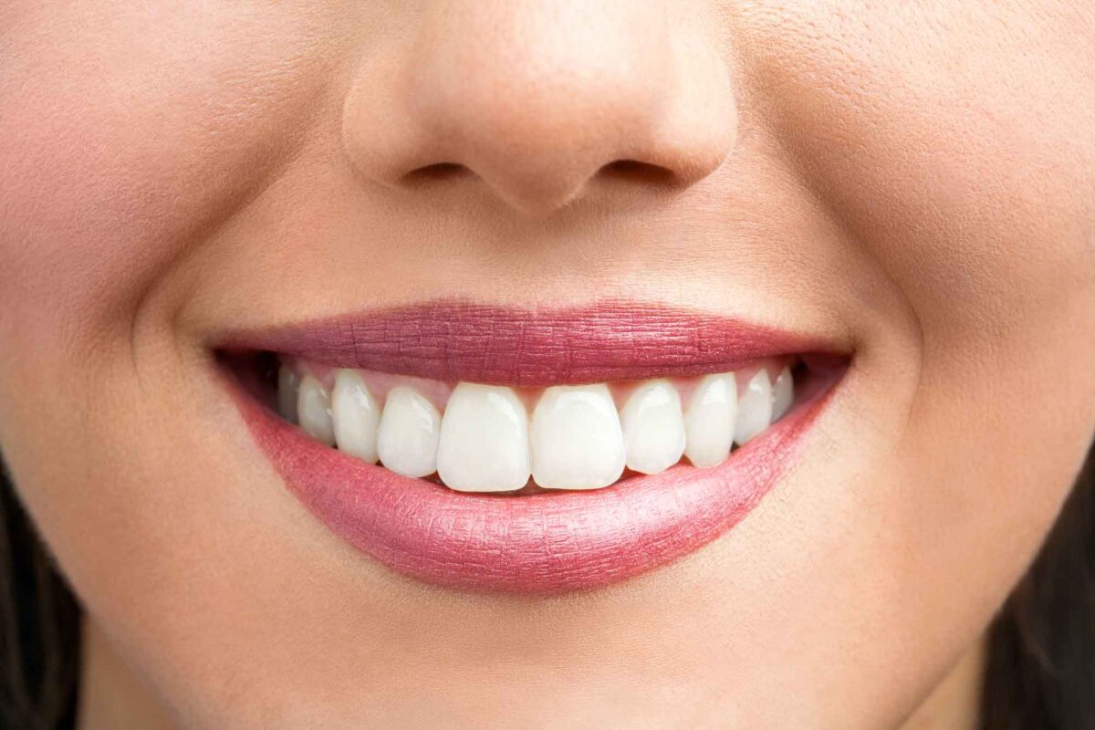 How Does Teeth Whitening Work