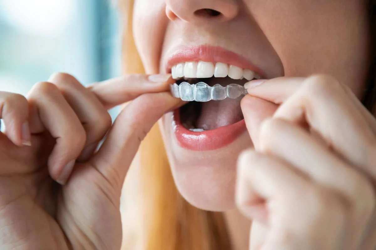woman putting on clear braces in las vegas