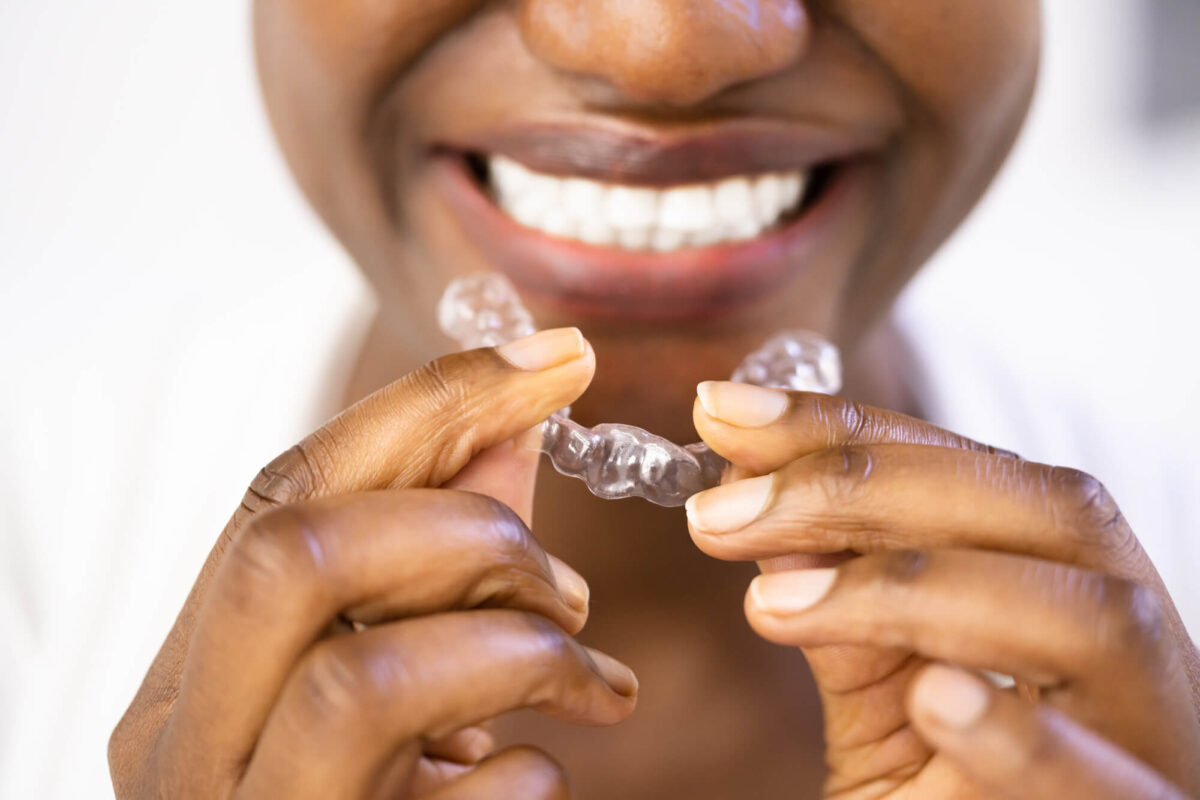 black woman about to wear clear braces las vegas