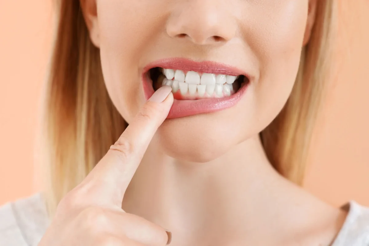 blonde woman with red gums needs to see a las vegas dentist