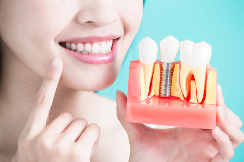 dental-implants-internal-img