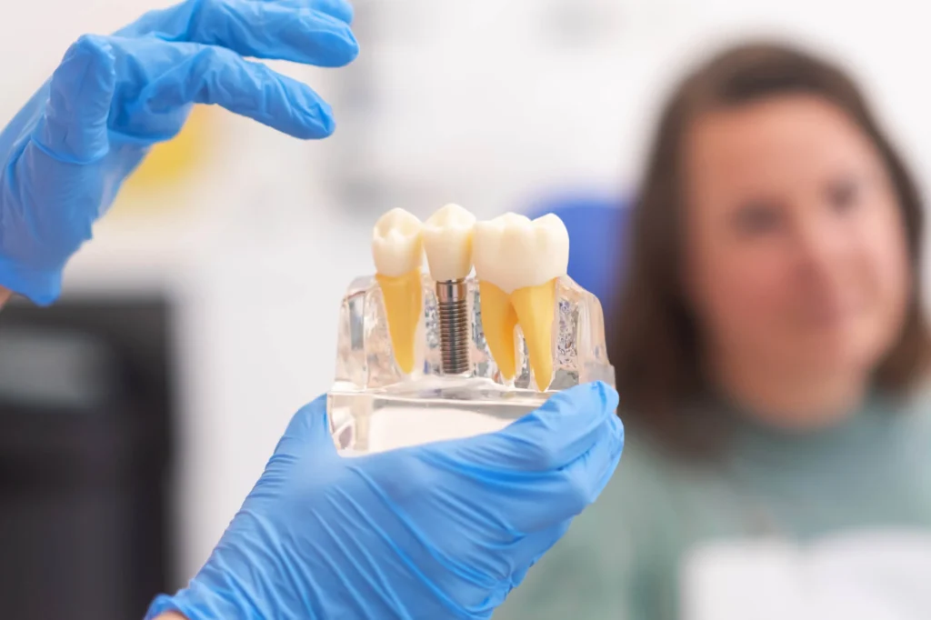 dentist showing patient a sample of affordable dental implants in las vegas