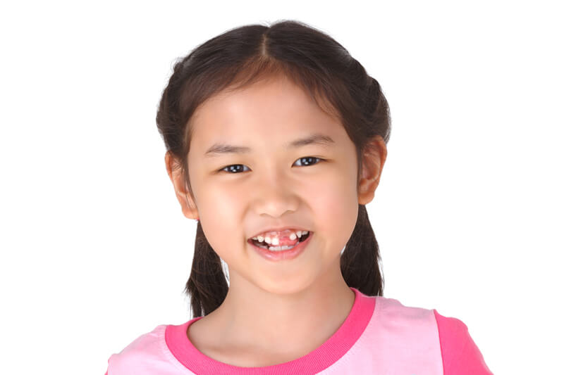 Young girl with a missing tooth.