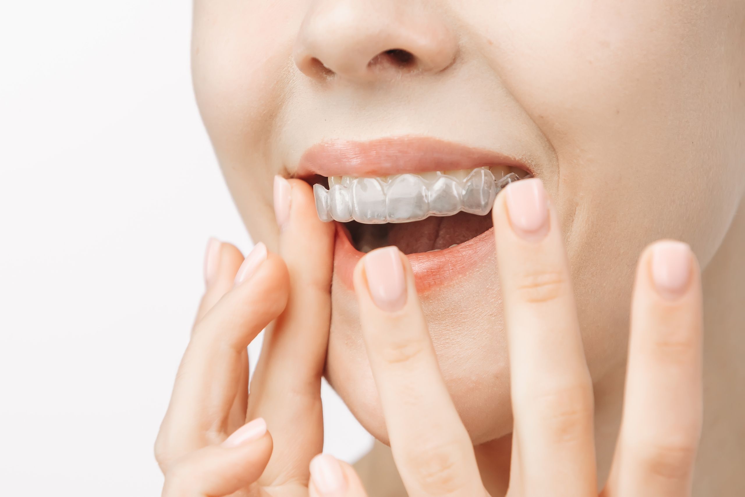 Happy adult with a bright smile wearing clear aligners